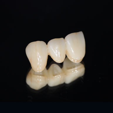 全鋯冠<br><span>Monolithic Zirconia Crown</span>