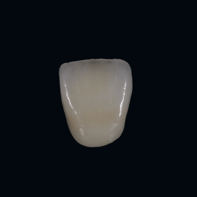 全瓷冠<br><span>Porcelain Fused to Zirconia</span>